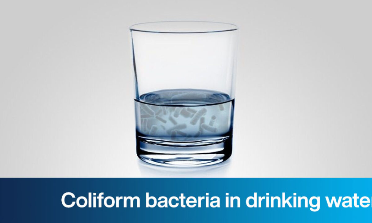 https://www.carbotecnia.info/wp-content/uploads/2020/11/coliform_bacteria-1200x720.jpg